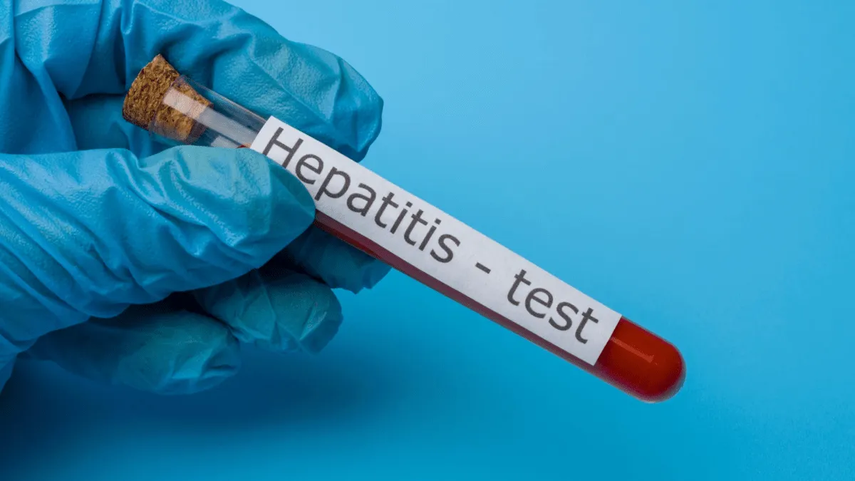 Hepatitis aguda grave en México: Estos son los estados afectados